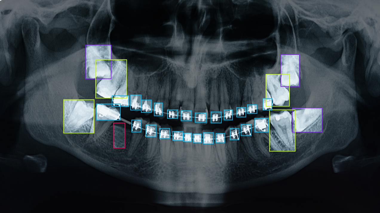 Annotated Dental X-ray